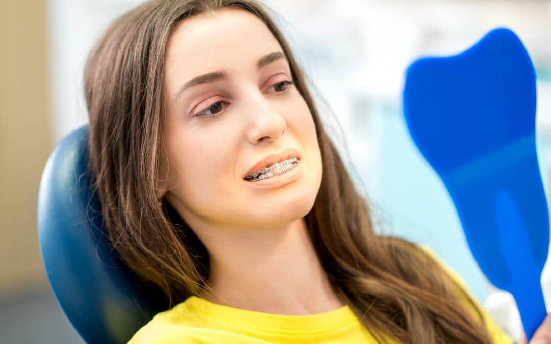 How Long Do Braces Take?