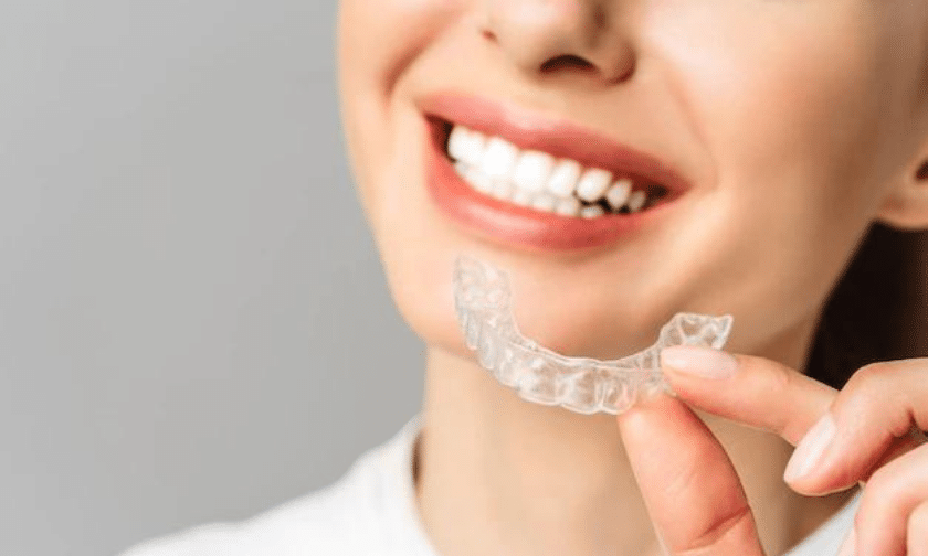 Invisalign