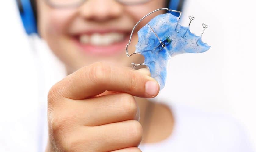Benefits of SmartClip Technology in Orthodontic Treatment