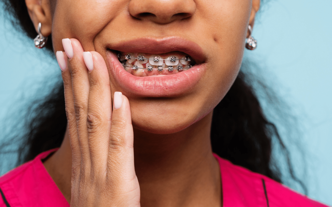 5 Common Orthodontic Problems You Can Fix at Home
