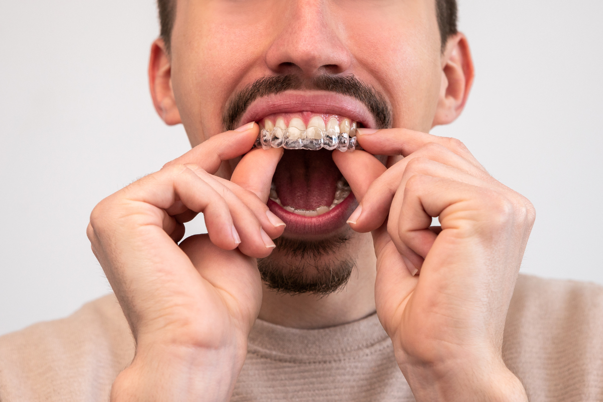 Invisalign in Merrick for Adults