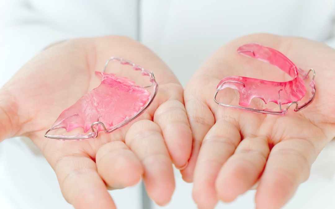 Can Retainers Fix an Overbite? Here’s What You Should Know