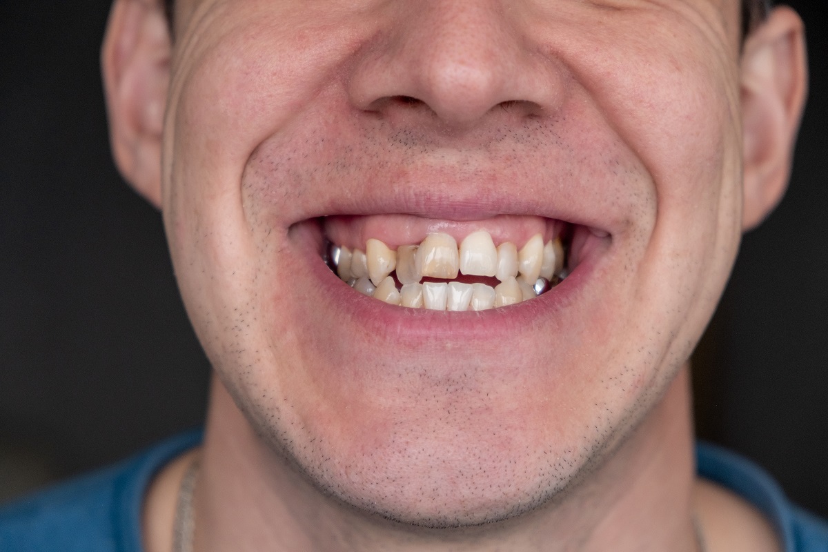 bite problems when to see an orthodontist in merrick