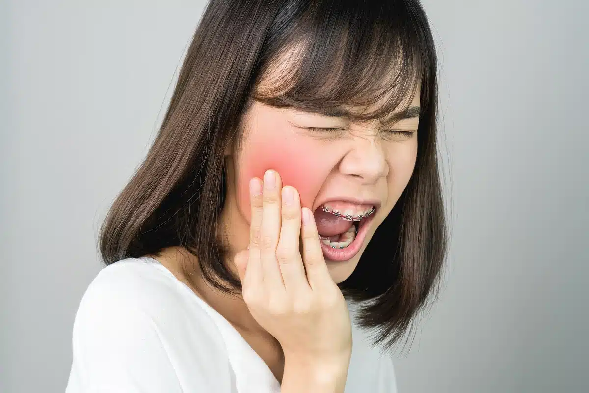 Swallowed retainer wire or braces wire